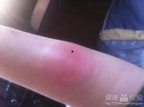 风疹吃角瓜,角瓜助力康复之旅